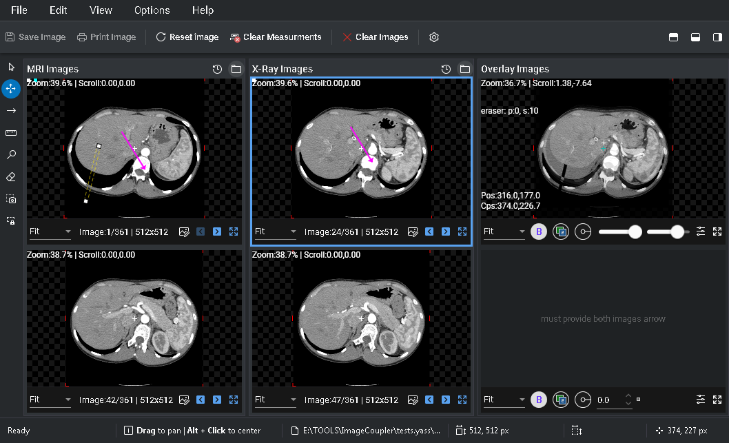 Medical Image Coupling Software - Main Window